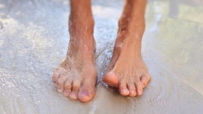 walking barefoot as a way to get a fungus